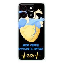 ЗСУ Чехлы (TPU) для ZTE Blade A35 – Ритм ЗСУ