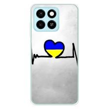 Силиконовый Чехол на ZTE Blade A55 (Я-Украина) – Украинская кардиограмма