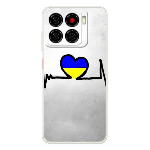 Силіконовий Чохол  на ZTE Blade A56 (Я-Україна) – Українська кардіограма