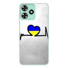Силиконовый Чехол на ZTE Blade A73 (Я-Украина) – Украинская кардиограмма