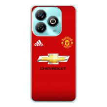 Силіконові Чохли з принтом Футбол на ZTE Blade A75 (Man United)