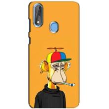 Чехлы с Обезьянами NFT для ZTE Blade V10 (AlphaPrint) (Скучающая Обезьяна NFT)