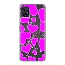 Чехлы для любимой на ЗТЕ Блэйд В2020 Смарт (VPrint) (Pink hearts)