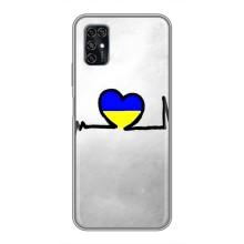 Силиконовый Чехол на ZTE Blade V2020 Smart (Я-Украина) – Украинская кардиограмма