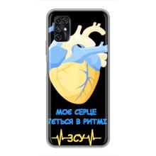 ЗСУ Чехлы (TPU) для ZTE Blade V2020 Smart – Ритм ЗСУ
