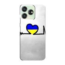 Силіконовий Чохол  на ZTE Blade V50 Design (Я-Україна) – Українська кардіограма