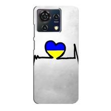 Силиконовый Чехол на ZTE Blade V50 Vita (Я-Украина) – Украинская кардиограмма