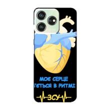 ЗСУ Чохли (TPU) для ZTE Blade V50 – Ритм ЗСУ
