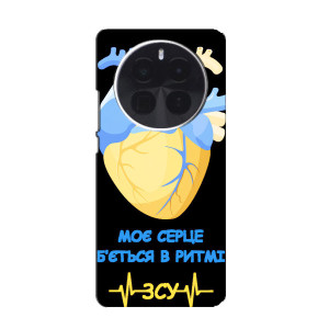 ЗСУ Чехлы (TPU) для ZTE Blade V70 Max – Ритм ЗСУ
