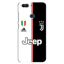 Чехлы для ZTE Blade V9 (VPrint) - Футбольные клубы (Juventus)