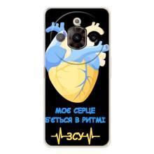 ЗСУ Чехлы (TPU) для ZTE Nubia Focus Pro – Ритм ЗСУ