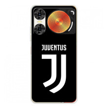 Чехлы для ZTE Nubia Music 2 (VPrint) - Футбольные клубы (ФК Ювентус)