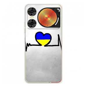 Силіконовий Чохол  на ZTE Nubia Music 2 (Я-Україна) (Українська кардіограма)