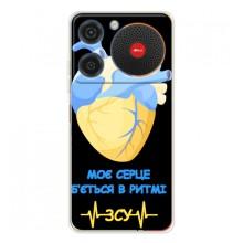 ЗСУ Чехлы (TPU) для ZTE Nubia Music – Ритм ЗСУ