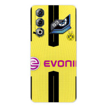 Чохли для ZTE Nubia Neo 3 GT (VPrint) - Футбольні клуби (BVB)