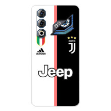 Чохли для ZTE Nubia Neo 3 GT (VPrint) - Футбольні клуби (Juventus)