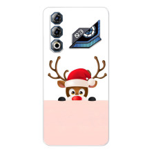 Чехол Санта Клаус для ZTE Nubia Neo 3 GT – Олененок