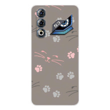 Чохол з малюнком кіт на ZTE Nubia Neo 3 GT (Лапи і вуса)