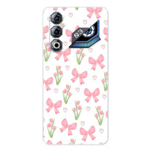 Чохол з бантиками на ЗТЕ Нyбia Нeo 3 ҐТ – Банти і квіти