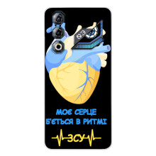 ЗСУ Чехлы (TPU) для ZTE Nubia Neo 3 GT (Ритм ЗСУ)