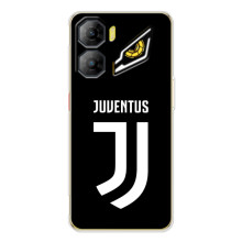 Чохли для ZTE Nubia Neo 3 (VPrint) - Футбольні клуби (ФК Ювентус)
