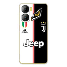 Чохли для ZTE Nubia Neo 3 (VPrint) - Футбольні клуби (Juventus)