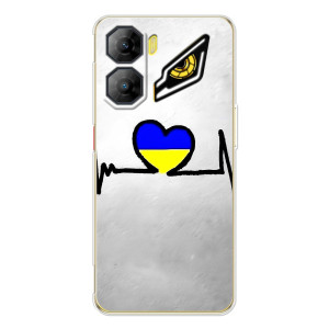 Силиконовый Чехол на ZTE Nubia Neo 3 (Я-Украина) – Украинская кардиограмма