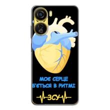 ЗСУ Чохли (TPU) для ZTE Nubia Neo 5G (Ритм ЗСУ)
