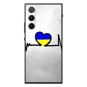 Силиконовый Чехол на ZTE Nubia RedMagic 10 Air (Я-Украина) – Украинская кардиограмма