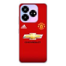 Силіконові Чохли з принтом Футбол на ZTE Nubia V60 Design – Man United