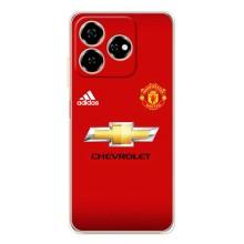 Силіконові Чохли з принтом Футбол на ZTE Nubia V60 – Man United