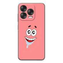 Чехлы с Патриком на ZTE Nubia V70 Design (Мордочка Патрика)