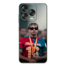 Чехол с футболистом Ламин Ямаль ZTE Nubia V70 Design (Ямаль Барса)