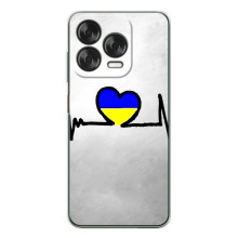 Силиконовый Чехол на ZTE Nubia V70 Design (Я-Украина) – Украинская кардиограмма