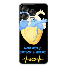 ЗСУ Чехлы (TPU) для ZTE Nubia V70 Design (Ритм ЗСУ)