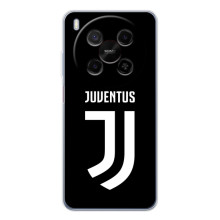 Чехлы для ZTE Nubia V70 Max (VPrint) - Футбольные клубы (ФК Ювентус)