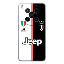 Чехлы для ZTE Nubia V70 Max (VPrint) - Футбольные клубы (Juventus)