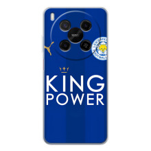 Чехлы для ZTE Nubia V70 Max (VPrint) - Футбольные клубы (Lester)