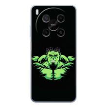 Чехлы с героями Марвел ZTE Nubia V70 Max (VPrint) (Зелёный Халк)