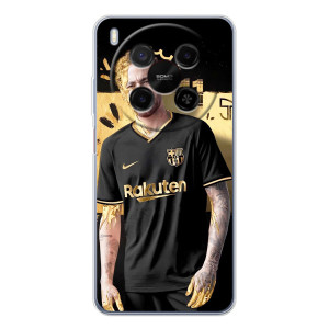 Силиконовый Чехол ZTE Nubia V70 Max – Gold Neymar