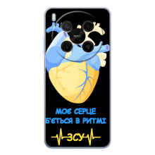 ЗСУ Чохли (TPU) для ZTE Nubia V70 Max – Ритм ЗСУ