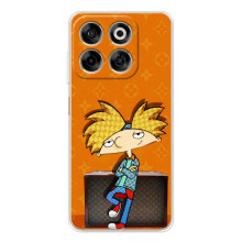 Бренднові Чохли для ZTE Nubia V70 - (PREMIUMPrint) (Арнольд)