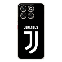 Чохли для ZTE Nubia V70 (VPrint) - Футбольні клуби (ФК Ювентус)