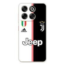 Чохли для ZTE Nubia V70 (VPrint) - Футбольні клуби (Juventus)
