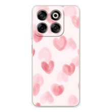 Чехол с розовым рисунком для ZTE Nubia V70 – Розовые сердечки