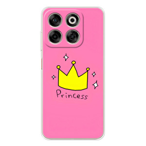Девчачий Чехол для ZTE Nubia V70 – Princess