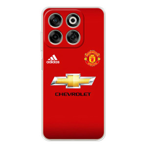 Силиконовые Чехлы принт Футбол на ZTE Nubia V70 – Man United