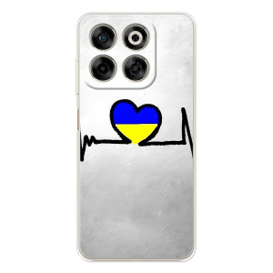 Силиконовый Чехол на ZTE Nubia V70 (Я-Украина) – Украинская кардиограмма