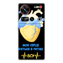 ЗСУ Чохли (TPU) для ZTE Nubia Z70 Ultra – Ритм ЗСУ