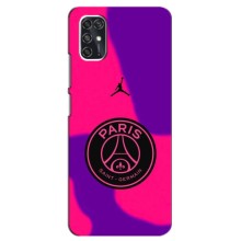 Чехлы PSG для ZTE V2020 Smart (AlphaPrint) (яркий ПСЖ)